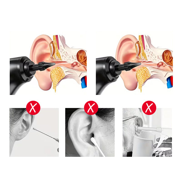 Nettoyeur d'oreilles pour rincer les oreilles à l'eau