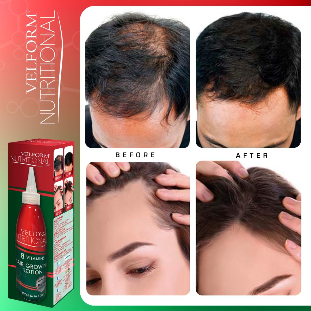 Lotion nutritive pour la croissance des cheveux 1+1 Velform, 2 x 200 ml